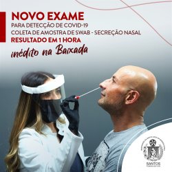 Novo exame para Covid-19 chega na Santa Casa de Santos! Exame de antígeno pode ser feito no 1º dia de contato com o vírus